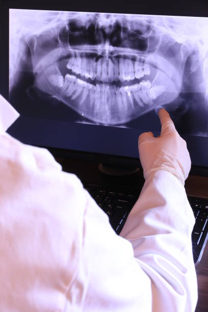 Best Emergency Dental Care for Abscessed Tooth in Nett, MO